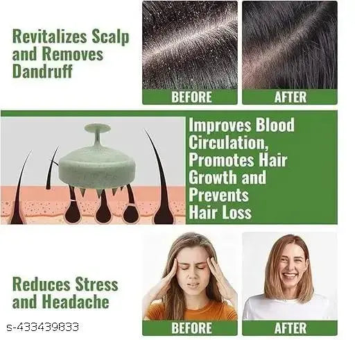 Scalp Massager Brush – Hair & Head Massager for Hair Growth, Shampoo & Wash Brush (Marble Green)